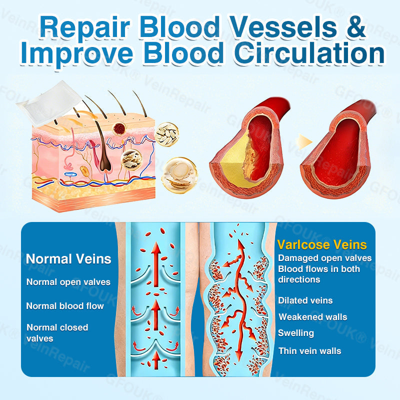 🇺🇸🏅🌱HERB & VITAL Official Store -  VeinRepair Microneedle Patch Roll⚡Instant Relief, Long-Term Results