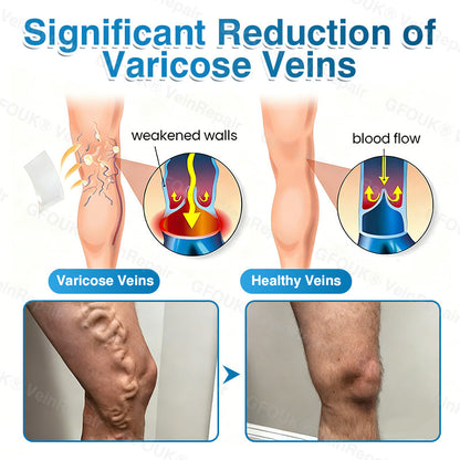 🇺🇸🏅🌱HERB & VITAL Official Store -  VeinRepair Microneedle Patch Roll⚡Instant Relief, Long-Term Results