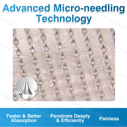 🇺🇸🏅🌱HERB & VITAL Official Store -  VeinRepair Microneedle Patch Roll⚡Instant Relief, Long-Term Results