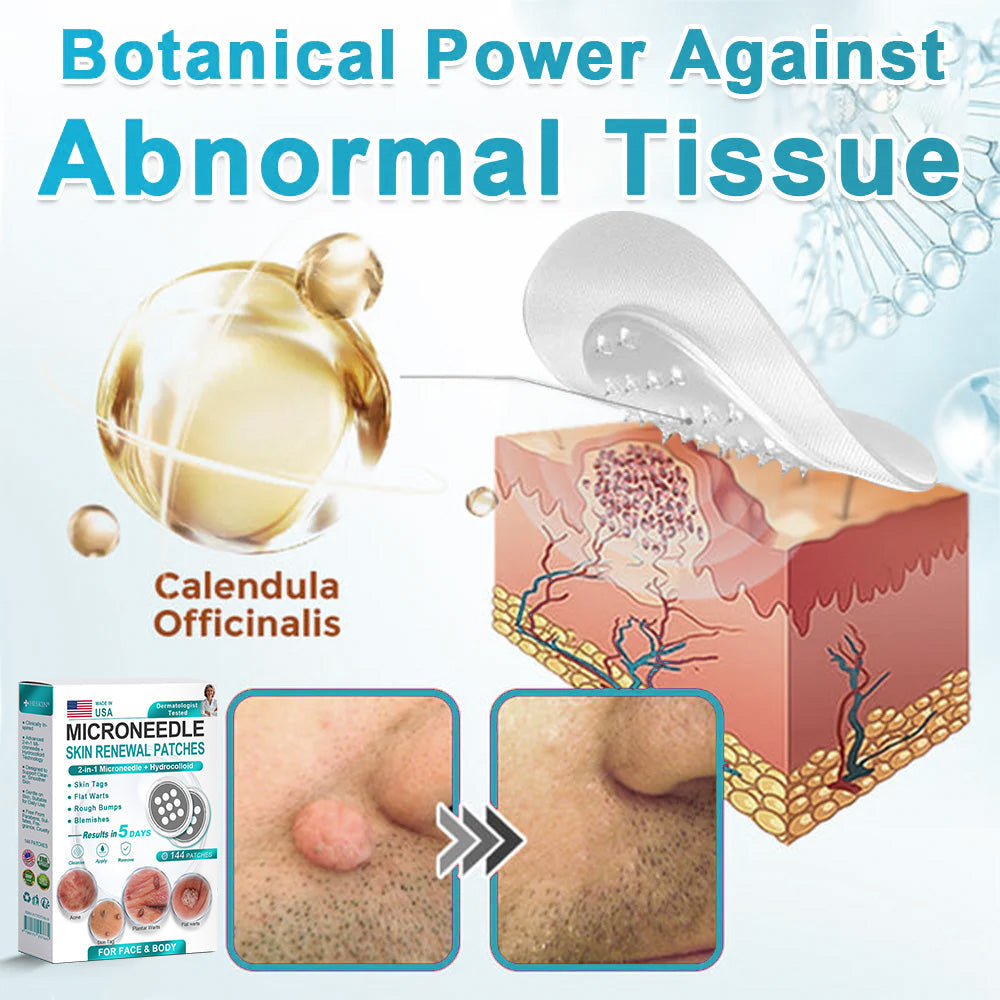 HERB & VITAL Official Store -  2-in-1 Microneedle & Hydrocolloid Patch👨‍⚕️ | Removes raised moles, acne, flat warts, and skin tags | Helps improve wrinkles, scars, and blemishes | Invisible patches for face and body