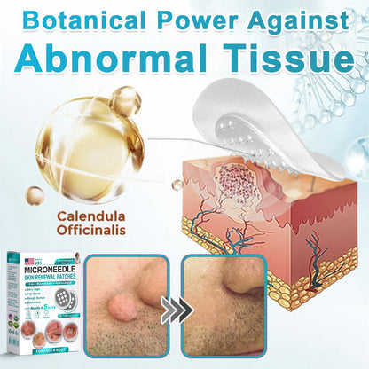 HERB & VITAL Official Store -  2-in-1 Microneedle & Hydrocolloid Patch👨‍⚕️ | Removes raised moles, acne, flat warts, and skin tags | Helps improve wrinkles, scars, and blemishes | Invisible patches for face and body