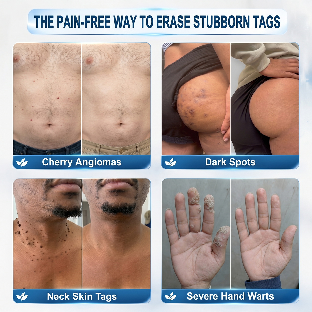 HERB & VITAL Official Store - 7 𝐷𝑎𝑦 𝗧𝐚𝐠 & 𝗦𝗽𝐨𝐭 𝐄𝐫𝒂𝒔𝒆𝒓(Zero Pain, Zero 𝐒𝐜𝐚𝒓𝒔 Rollerball)💎