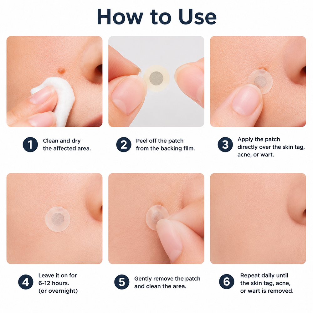 HERB & VITAL Official Store -  2-in-1 Microneedle & Hydrocolloid Patch👨‍⚕️ | Removes raised moles, acne, flat warts, and skin tags | Helps improve wrinkles, scars, and blemishes | Invisible patches for face and body